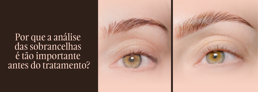 Porque é que a análise das sobrancelhas é tão importante antes do tratamento?